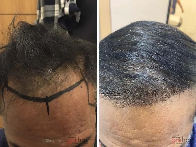 imgi_4_imageye___-_imgi_22_21-1