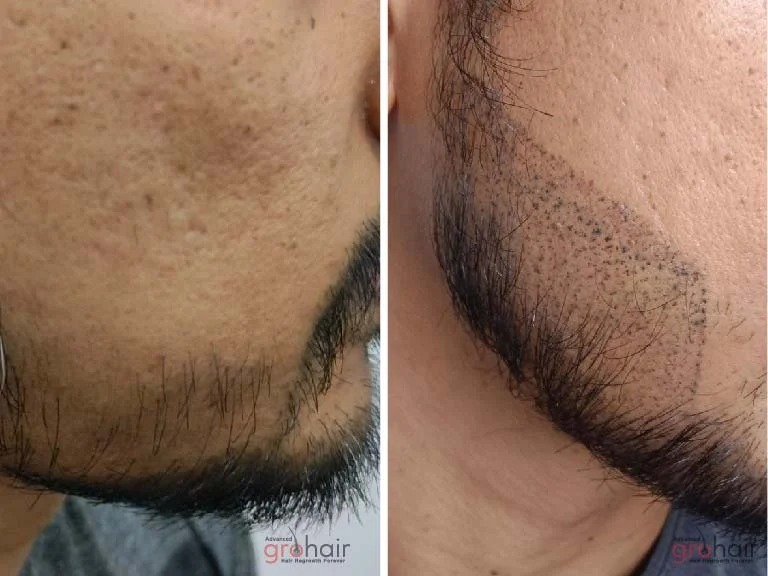 imgi_8_imageye___-_imgi_15_14